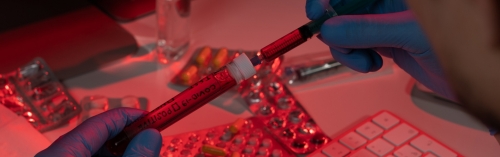 Клиника «Хадасса» в Сколково начала тестировать на антитела к коронавирусу